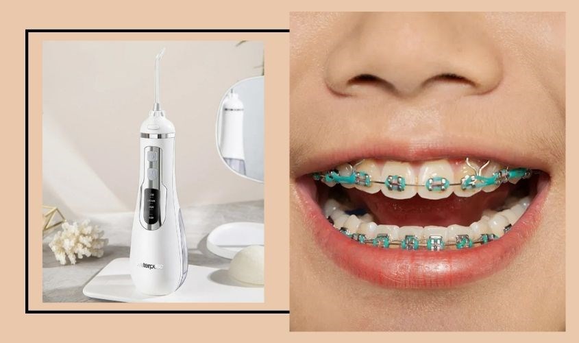 Máy tăm nước Waterpulse V500 Pro 