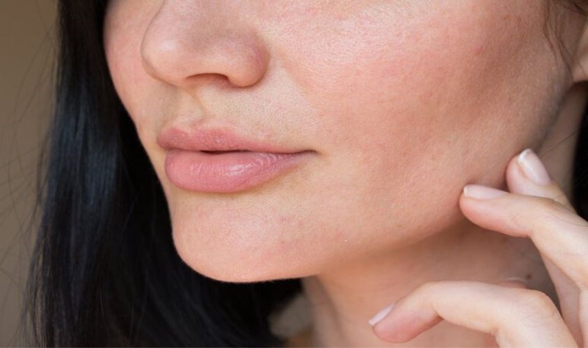 Mẹ bầu thuộc da hỗn hợp nên chọn sản phẩm dịu nhẹ 