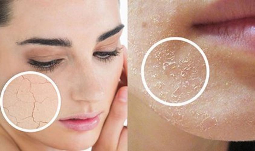 Mẹ bầu có làn da khô nên hạn chế rửa mặt nhiều lần để tránh mất nước