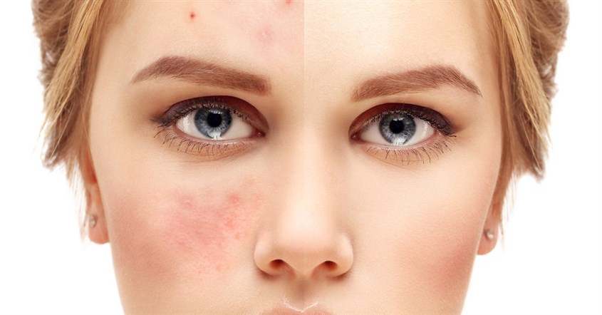 Lựa chọn máy rửa mặt phù hợp để cải thiện làn da Lựa chọn máy rửa mặt phù hợp để cải thiện làn da