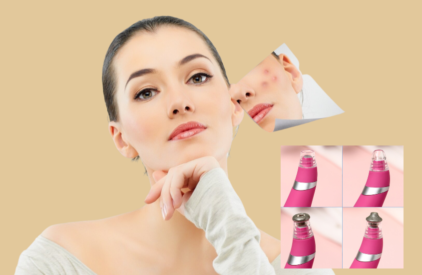 Máy hút mụn giúp loại bỏ sạch da chết và bã nhờn