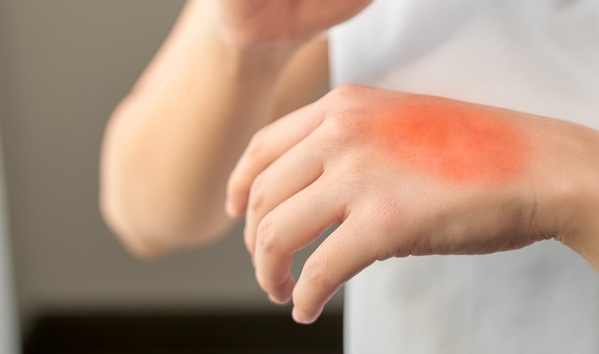 Tẩy tế bào chết ngăn ngừa bệnh về da