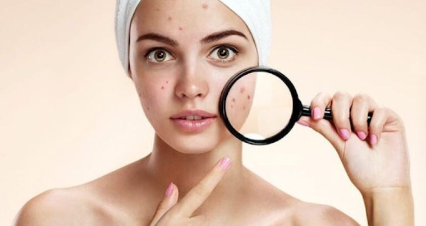 Việc đổi sữa rửa mặt thường xuyên cũng có thể đem tới nhiều tác hại