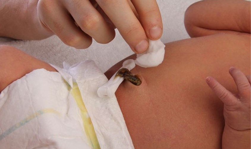 Cuốn rốn của trẻ sơ sinh