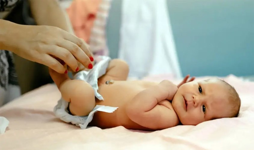 Khi đóng bỉm cho bé cần tránh chạm vào phần cuống rốn chưa rụng Khi đóng bỉm cho bé cần tránh chạm vào phần cuống rốn chưa rụng