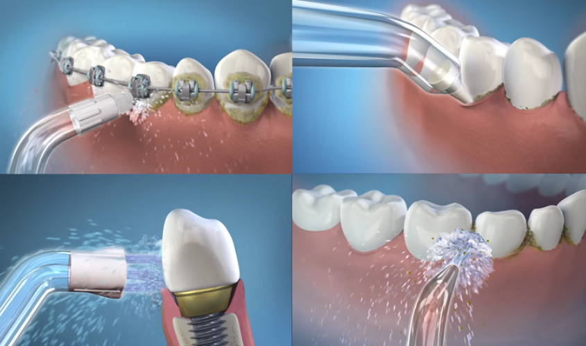 Hướng dẫn sử dụng máy tăm nước