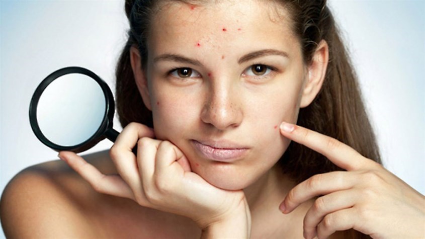 Dùng mỹ phẩm kém chất lượng