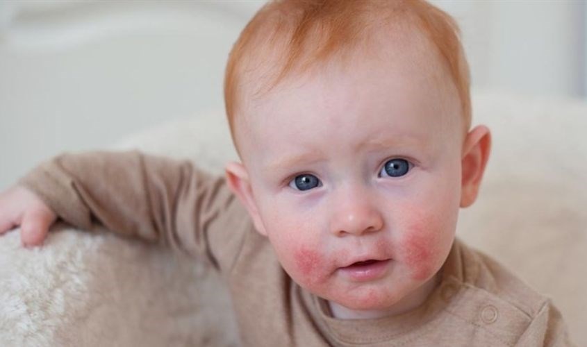 Có chứa đậu nành nên có thể dị ứng với một số bé