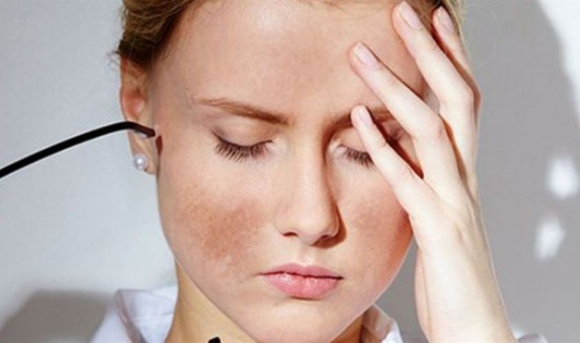 Sữa tươi làm sạm da do cơ chế tự bảo vệ