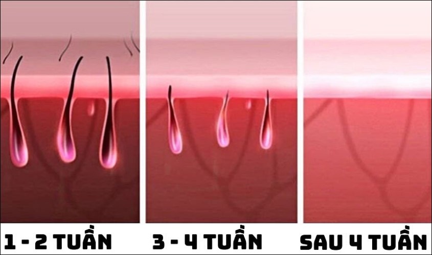 Mức độ lông mọc lại sau khi sử dụng máy triệt lông mini