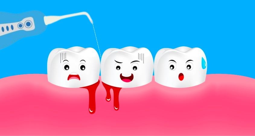 Nên sử sụng máy tăm nước sau các bữa ăn trong ngày