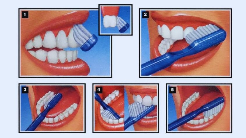 Chải răng trong khoảng từ 2 - 3 phút