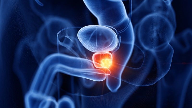Thủ dâm giảm nguy cơ mắc ung thư tuyến tiền liệt