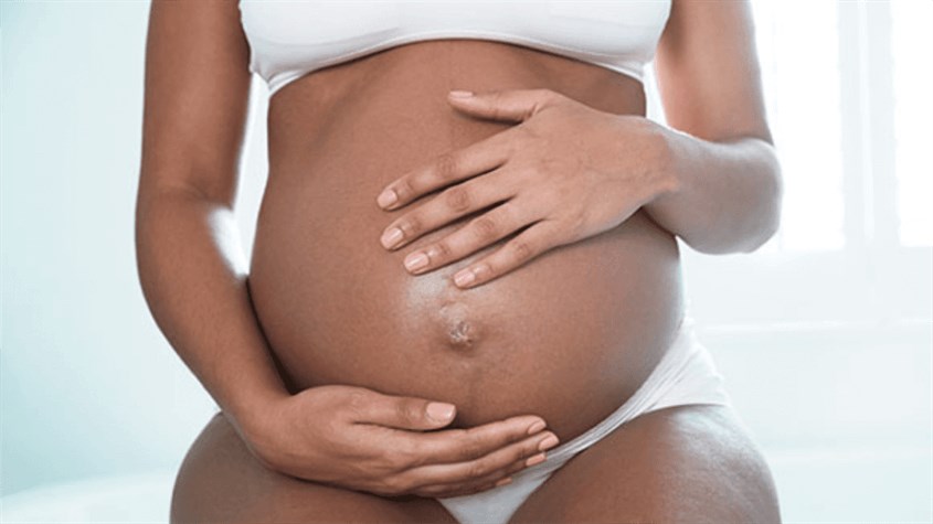 Tình trạng rạn da cũng có thể do di truyền. Nguồn ảnh: Mama Mio