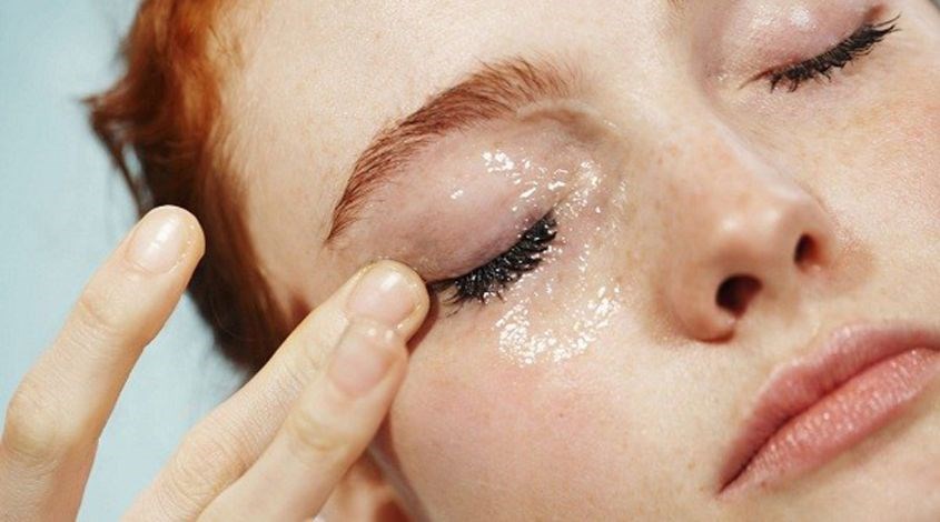 Nên nhũ hóa kỹ khi dùng dầu tẩy trang để ngăn ngừa mụn