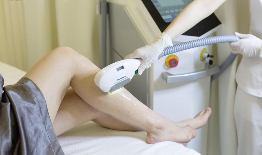 Không có phương pháp nào loại bỏ hoàn toàn và có khả năng triệt lông vĩnh viễn