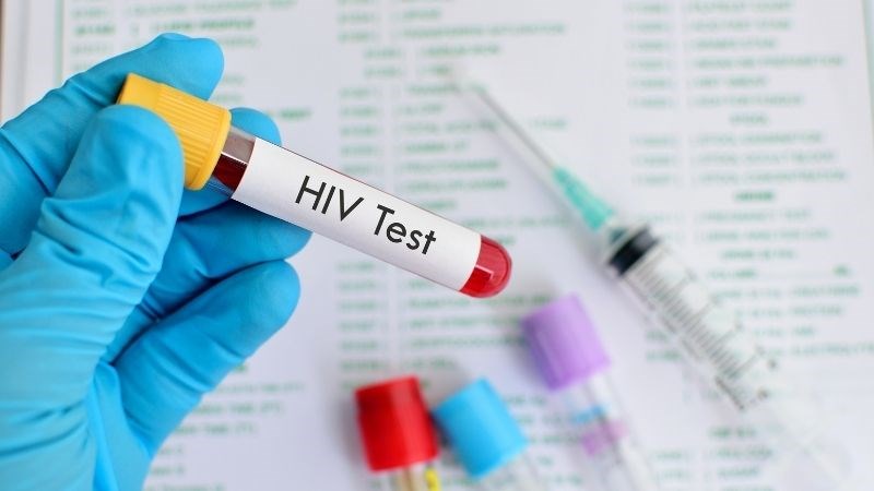 Nên xét nghiệm HIV sau 2 - 3 tháng