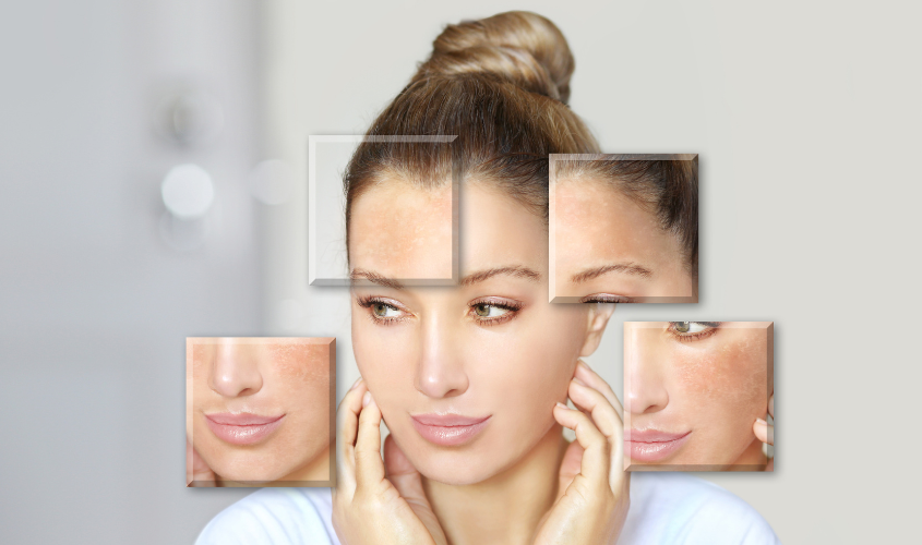 Da bị thiếu độ ẩm khi dùng kem chống nắng vào ban đêm 