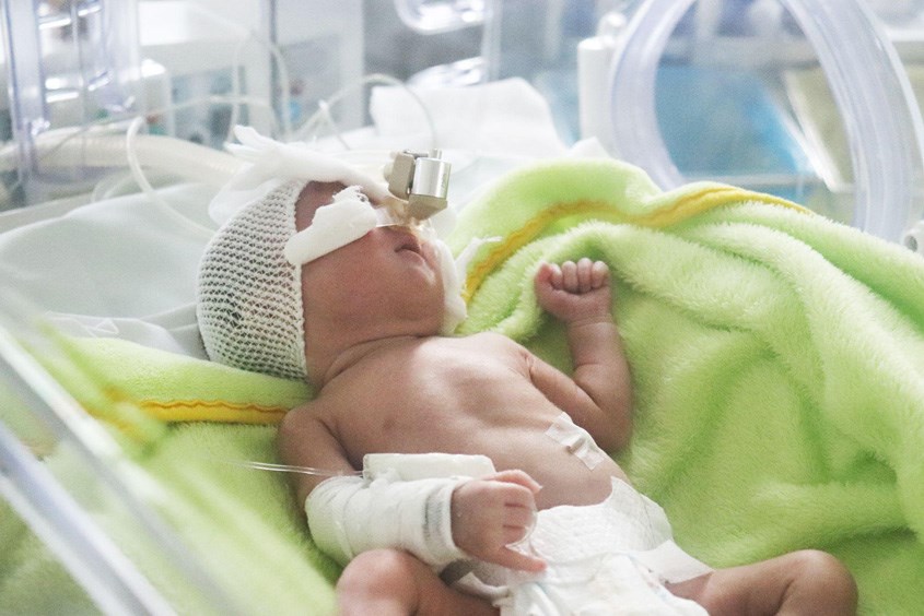 Mẹ bị thủy đậu có thể bị chuyển dạ sinh non