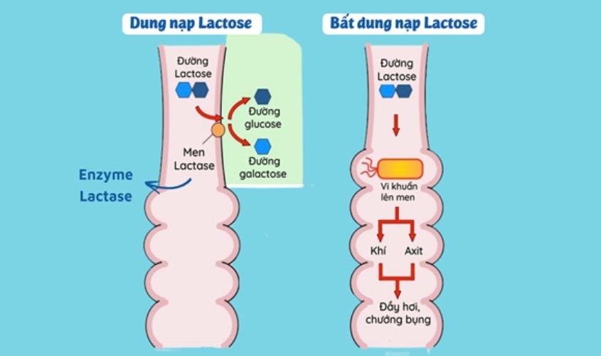 Bản chất của bất dung nạp lactose Bản chất của bất dung nạp lactose