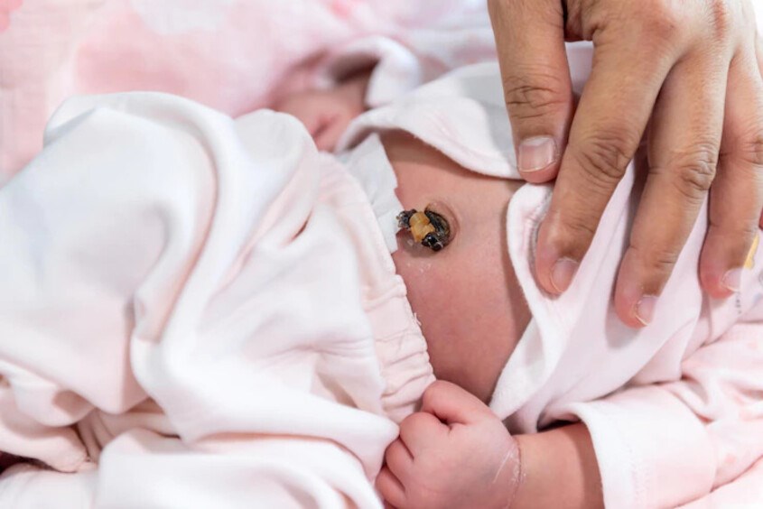 Từ 4 - 10 ngày sau sinh kẹp rốn sẽ tự rụng đi. Ảnh: freepik