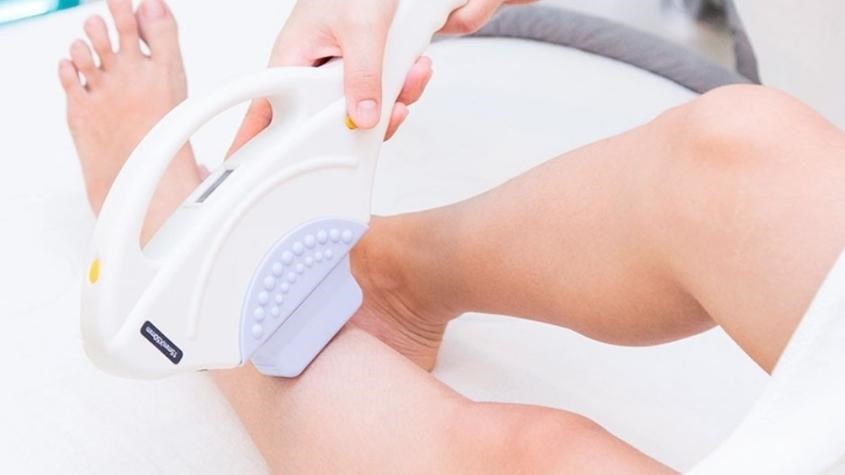 Tác dụng triệt lông duy trì trong thời gian dài