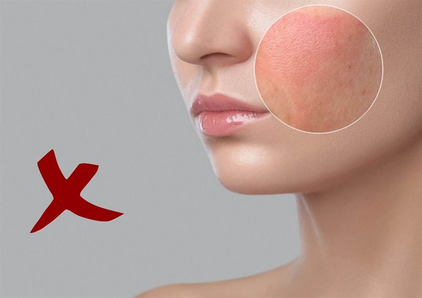 Dùng lực tẩy trang quá mạnh