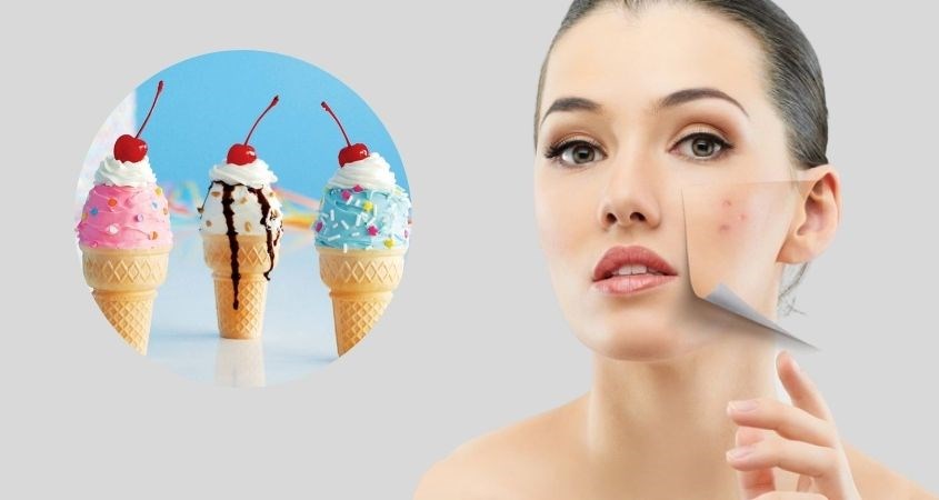 Nếu ăn kem quá nhiều cùng một lúc, bạn sẽ rất dễ nổi mụn