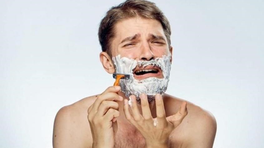 Cạo râu không đúng cách dẫn đến nổi mụn