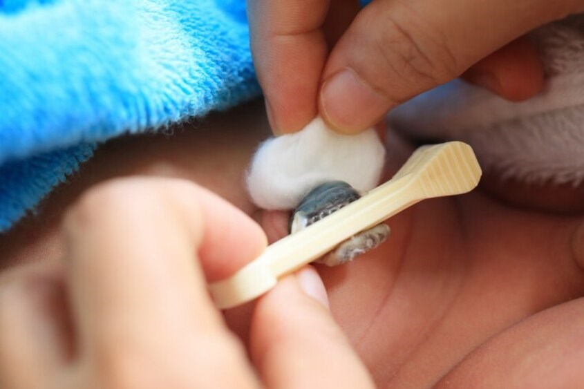 Ba mẹ chỉ nên vệ sinh cuống rốn của trẻ bằng gạc mềm. Ảnh: freepik