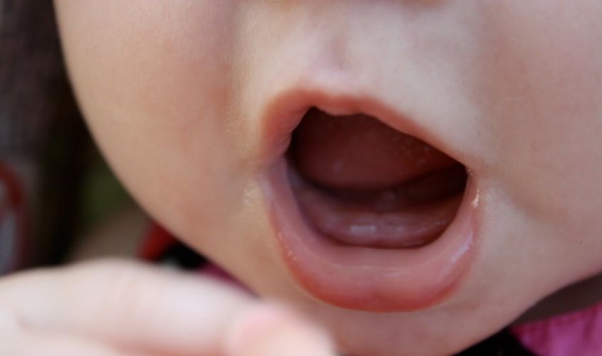 Răng sữa mọc chậm trong khoảng thời gian dài có thể khiến răng vĩnh viễn mọc chậm Răng sữa mọc chậm trong khoảng thời gian dài có thể khiến răng vĩnh viễn mọc chậm