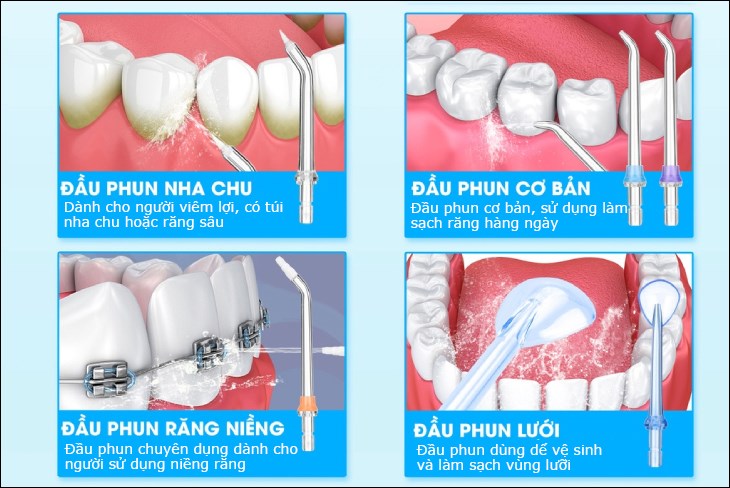 Bạn nên chọn đầu tăm nước phù hợp với tình trạng răng hiện tại để việc chăm sóc răng miệng hiệu quả hơn