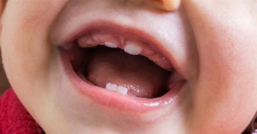 Trẻ mọc răng - Ba mẹ cần chăm sóc răng miệng cho trẻ ra sao?