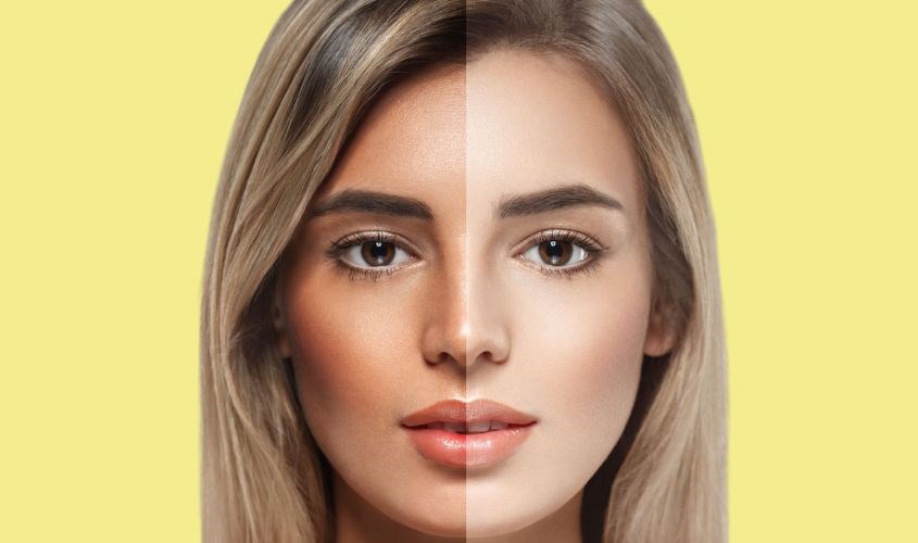 Hỗ trợ chống nám, sạm da