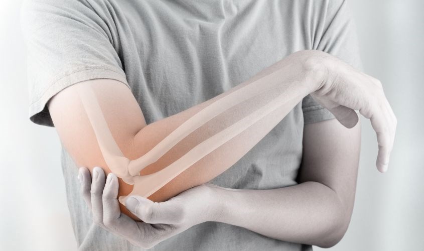 Vitamin D3 hỗ trợ cho sự hấp thu Canxi từ ruột non vào máu, làm dày mật độ xương