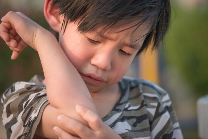 Trật khớp khuỷu tay trẻ em là gì