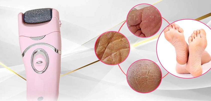Máy chà gót chân tẩy da chết Rio PEDI2
