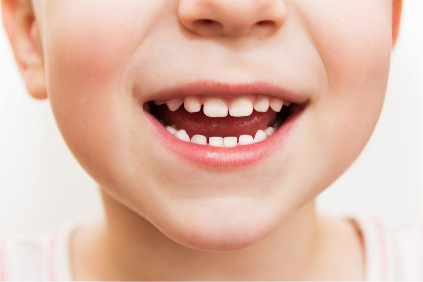 Nếu trẻ chậm mọc răng, cha mẹ cũng không cần quá lo lắng. Nguồn ảnh: Pediatric Dentist