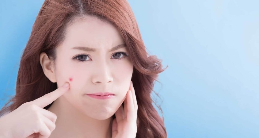 Mụn bọc, mụn mủ không tự ý cạo lông mặt 