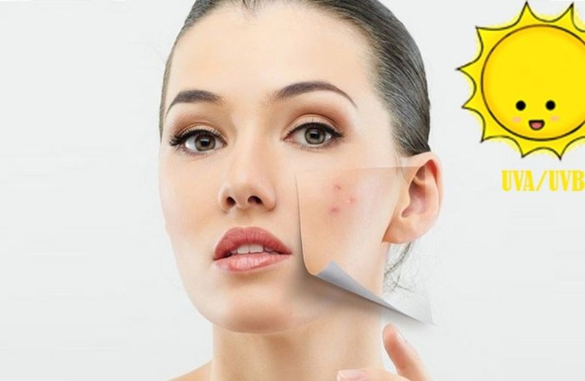 Thoa thuốc trị mụn trước khi sử dụng kem chống nắng