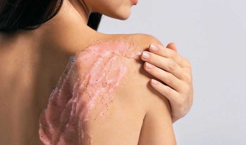 Cần chú ý tẩy kỹ lưỡng cho vùng da ngực và lưng