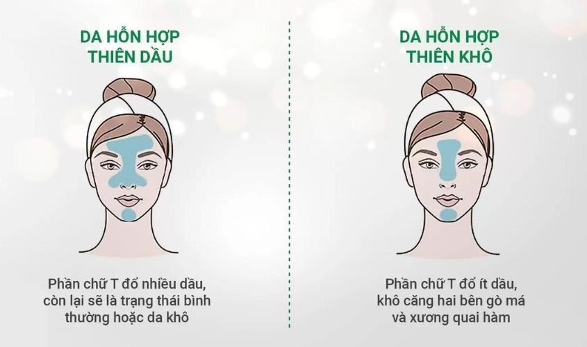 Cách phân biệt da hỗn hợp thiên dầu và thiên khô