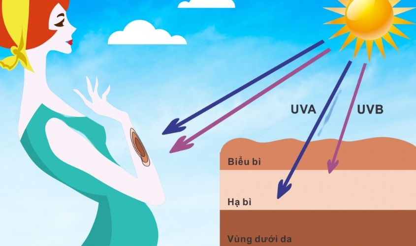 Tia UV gây nhiều ảnh hưởng tiêu cực lên làn da Tia UV gây nhiều ảnh hưởng tiêu cực lên làn da
