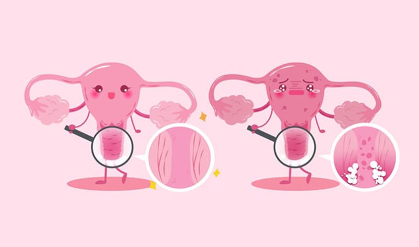 Hậu quả khi dùng dung dịch vệ sinh có nồng độ pH không phù hợp