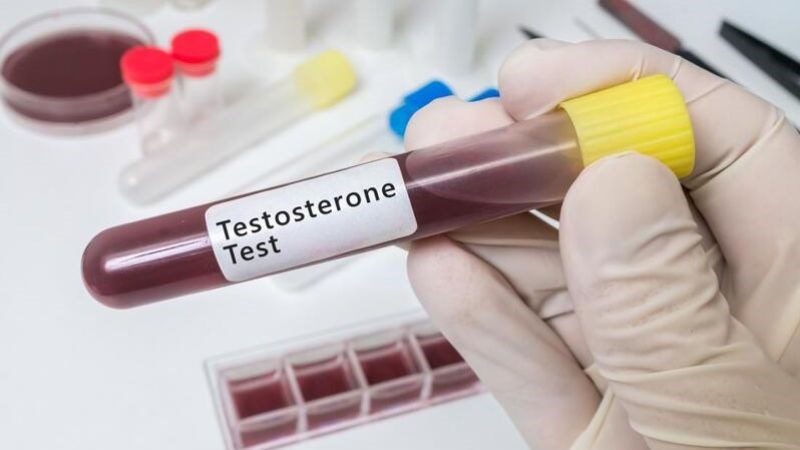 Mức testosterone <300 ng/dl đối với nam và <15 ng/dl đối với nữ được coi là thấp