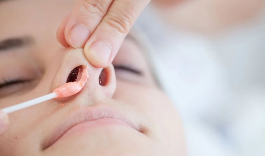Lưu ý khi nhổ lông mũi