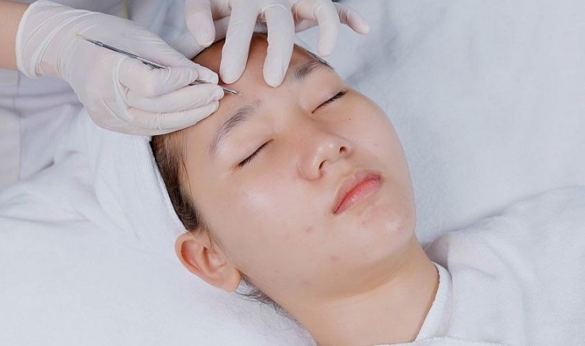 Nặn mụn ở spa là việc lựa chọn đúng đắn dành cho bạn