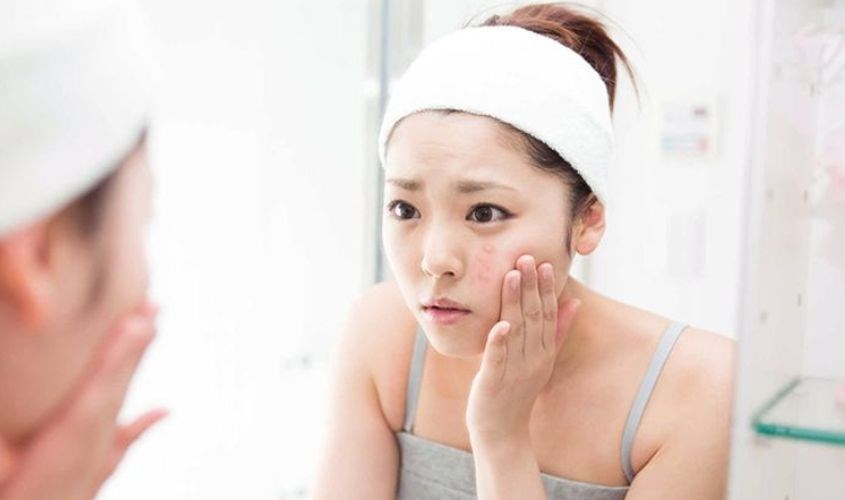 Việc nặn mụn có đau không tùy thuộc vào cơ địa