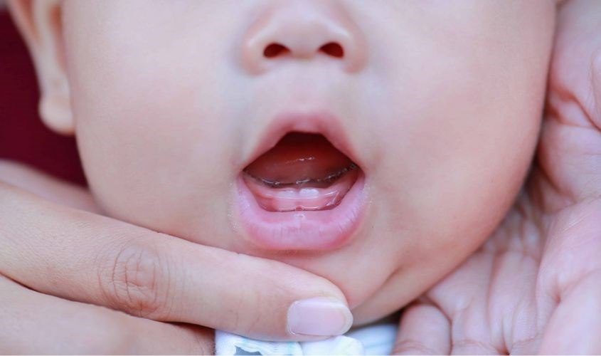 Từ 6 - 12 tháng tuổi trẻ mọc những chiếc răng đầu tiên. Nguồn: ingeniovirtual Từ 6 - 12 tháng tuổi trẻ mọc những chiếc răng đầu tiên. Nguồn: ingeniovirtual