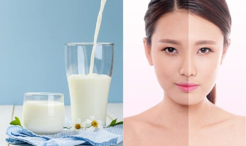 Dưỡng trắng và mờ thâm nhờ sữa tươi